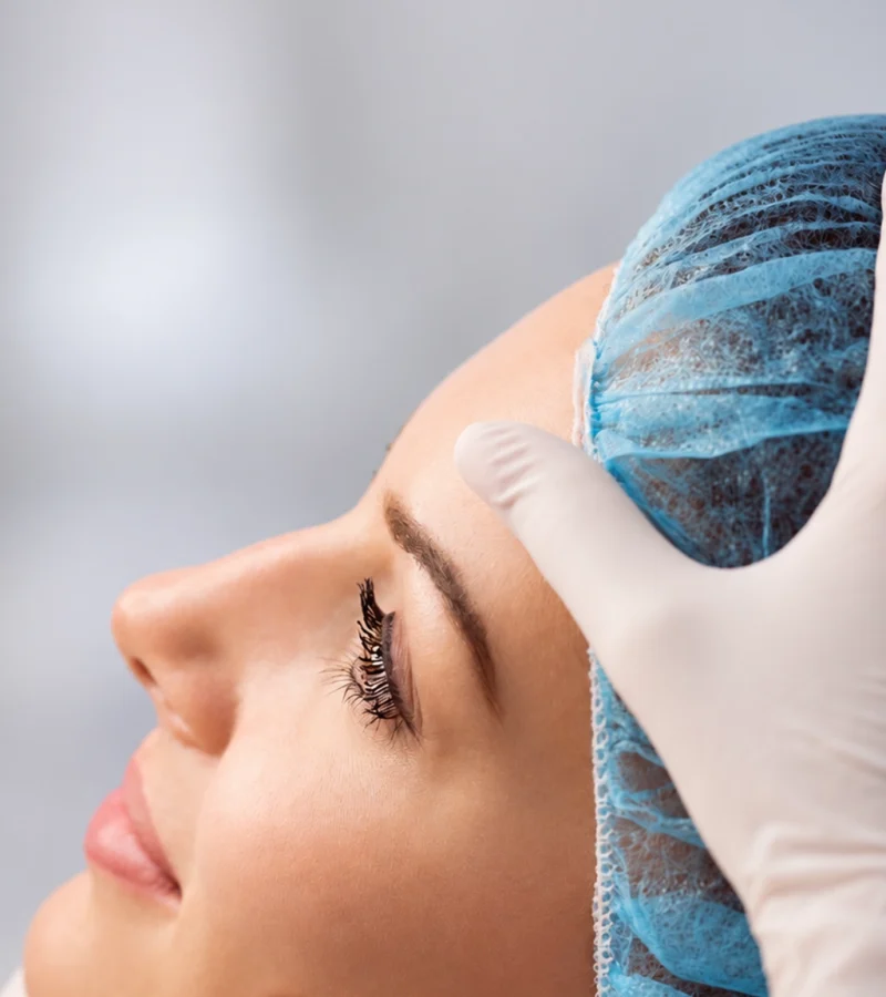 mezoterapia_skóry pod oczami Warszawa